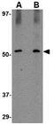 Sirtuin 2 antibody, GTX31335, GeneTex, Western Blot image 