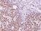 Aly/REF Export Factor antibody, PA5-22314, Invitrogen Antibodies, Immunohistochemistry paraffin image 