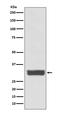 Galectin 3 antibody, M00621, Boster Biological Technology, Western Blot image 