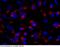 Adenosine Deaminase antibody, 100833-T38, Sino Biological, Immunohistochemistry paraffin image 