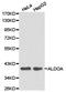 Aldolase, Fructose-Bisphosphate A antibody, TA326946, Origene, Western Blot image 