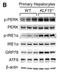 Endoplasmic Reticulum To Nucleus Signaling 1 antibody, NB100-2323, Novus Biologicals, Western Blot image 