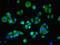 Asparaginyl-TRNA Synthetase antibody, LS-C396852, Lifespan Biosciences, Immunofluorescence image 