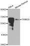 Tripartite Motif Containing 29 antibody, abx007003, Abbexa, Western Blot image 