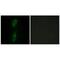 Activin A Receptor Like Type 1 antibody, PA5-49803, Invitrogen Antibodies, Immunofluorescence image 