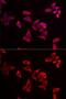 Ribosomal Protein L9 antibody, GTX55785, GeneTex, Immunofluorescence image 