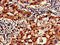 Calpain 1 antibody, LS-C677382, Lifespan Biosciences, Immunohistochemistry paraffin image 