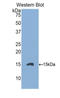 Endoglin antibody, LS-C293755, Lifespan Biosciences, Western Blot image 