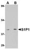 Sphingosine-1-Phosphate Receptor 1 antibody, orb75066, Biorbyt, Western Blot image 