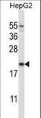 NADH:Ubiquinone Oxidoreductase Complex Assembly Factor 2 antibody, LS-C164803, Lifespan Biosciences, Western Blot image 