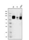 Discoidin Domain Receptor Tyrosine Kinase 2 antibody, PA1879, Boster Biological Technology, Western Blot image 