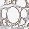 COMM Domain Containing 8 antibody, PA5-57446, Invitrogen Antibodies, Immunohistochemistry paraffin image 