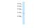 Potassium Voltage-Gated Channel Interacting Protein 4 antibody, A06511, Boster Biological Technology, Western Blot image 