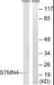 Stathmin 4 antibody, PA5-39485, Invitrogen Antibodies, Western Blot image 