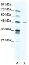 Nuclear Factor I C antibody, TA330085, Origene, Western Blot image 