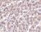 HtrA Serine Peptidase 2 antibody, PA5-20010, Invitrogen Antibodies, Immunohistochemistry paraffin image 