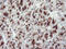 Golgi Membrane Protein 1 antibody, M02975-1, Boster Biological Technology, Immunohistochemistry paraffin image 