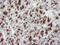 Golgi Membrane Protein 1 antibody, M02975-1, Boster Biological Technology, Immunohistochemistry paraffin image 