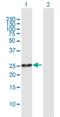 Phospholipase B Domain Containing 1 antibody, H00079887-D01P, Novus Biologicals, Western Blot image 