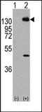 Platelet Derived Growth Factor Receptor Alpha antibody, AP14396PU-N, Origene, Western Blot image 