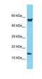 Actin Related Protein 2/3 Complex Subunit 5 antibody, orb326539, Biorbyt, Western Blot image 