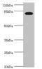 Interleukin-31 receptor subunit alpha antibody, LS-C675898, Lifespan Biosciences, Western Blot image 
