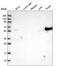 Keratin 6B antibody, HPA045697, Atlas Antibodies, Western Blot image 
