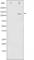 Cadherin 5 antibody, abx012161, Abbexa, Western Blot image 