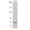 Guanylate Cyclase 1 Soluble Subunit Beta 1 antibody, LS-C383674, Lifespan Biosciences, Western Blot image 