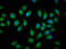 HECT, C2 And WW Domain Containing E3 Ubiquitin Protein Ligase 2 antibody, LS-C680580, Lifespan Biosciences, Immunofluorescence image 
