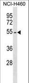 Erythropoietin Receptor antibody, LS-C167792, Lifespan Biosciences, Western Blot image 