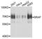 BRCA1-associated protein antibody, STJ111953, St John