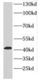 Delta Like Non-Canonical Notch Ligand 2 antibody, FNab02414, FineTest, Western Blot image 