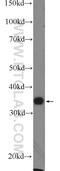 Forkhead Box S1 antibody, 16234-1-AP, Proteintech Group, Western Blot image 