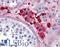 Adenosine A2a Receptor antibody, LS-A1237, Lifespan Biosciences, Immunohistochemistry paraffin image 