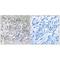 Sestrin 1 antibody, A05559, Boster Biological Technology, Immunohistochemistry paraffin image 