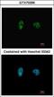 Checkpoint Kinase 2 antibody, GTX70295, GeneTex, Immunofluorescence image 