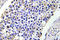 Aldose reductase antibody, LS-C177349, Lifespan Biosciences, Immunohistochemistry paraffin image 