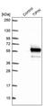 TIMELESS-interacting protein antibody, PA5-63616, Invitrogen Antibodies, Western Blot image 