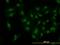 Cyclin Dependent Kinase 6 antibody, orb94628, Biorbyt, Immunofluorescence image 