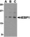Eukaryotic Translation Initiation Factor 4E Binding Protein 1 antibody, MBS150976, MyBioSource, Western Blot image 