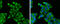Secreted Frizzled Related Protein 2 antibody, GTX111892, GeneTex, Immunocytochemistry image 