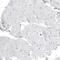 Leucine Zipper Like Transcription Regulator 1 antibody, NBP2-49649, Novus Biologicals, Immunohistochemistry paraffin image 