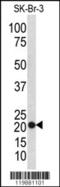 Transgelin antibody, MBS9209321, MyBioSource, Western Blot image 