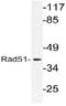RAD51 Recombinase antibody, AP21140PU-N, Origene, Western Blot image 
