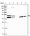 Tropomodulin 2 antibody, NBP1-87378, Novus Biologicals, Western Blot image 