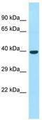 Fasciculation And Elongation Protein Zeta 2 antibody, TA333948, Origene, Western Blot image 