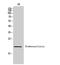 Betacellulin antibody, STJ97337, St John