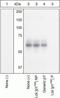 LCK Proto-Oncogene, Src Family Tyrosine Kinase antibody, GTX24900, GeneTex, Western Blot image 