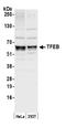 Transcription Factor EB antibody, A303-672A, Bethyl Labs, Western Blot image 